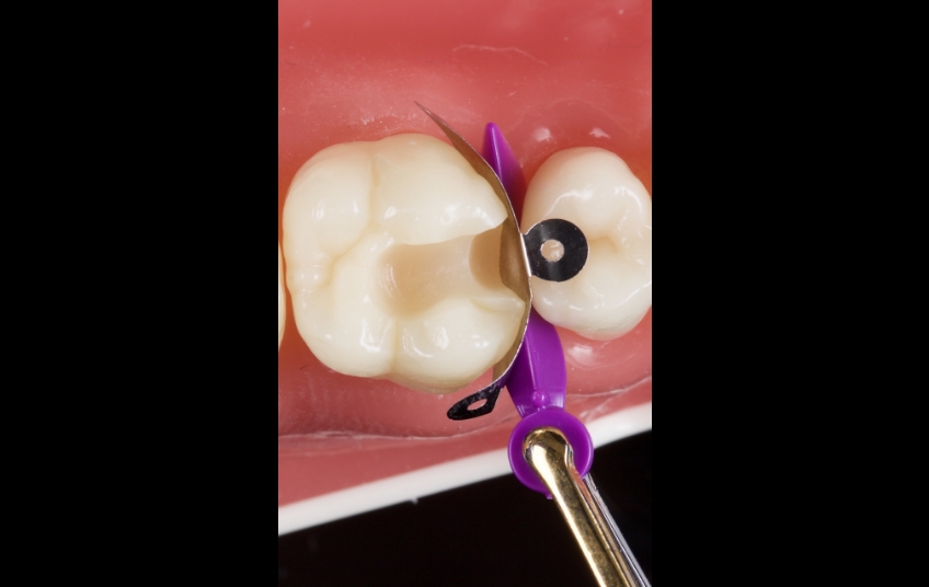 Jason Smithson Closing the Class 2 Restoration Box Part 2 Figure 8