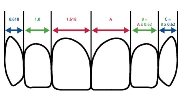 Managing the Midline Diastema Part 2: Challenges Jason Smithson Managing the Midline Diastema Part 2 Featured Image