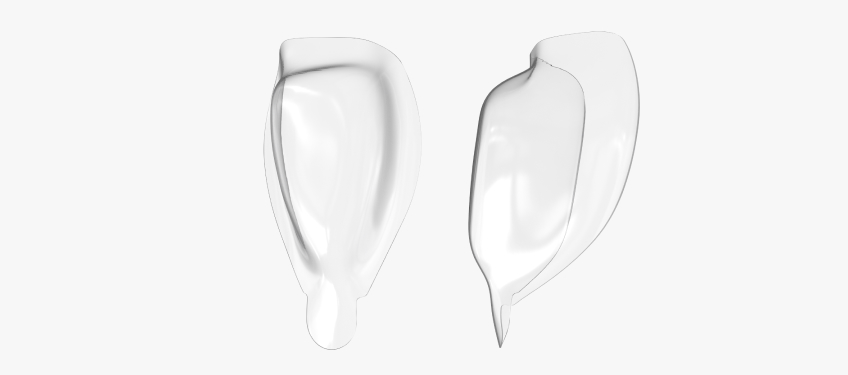 Managing the Midline Diastema Part 2: Challenges Jason Smithson Managing the Midline Diastema Part 2 Figure 13