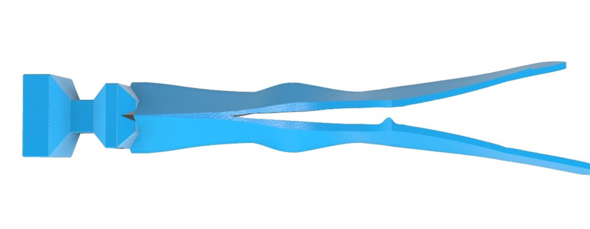 Managing the Midline Diastema Part 2: Challenges Jason Smithson Managing the Midline Diastema Part 2 Figure 20