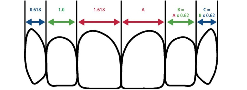 Managing the Midline Diastema Part 2: Challenges Jason Smithson Managing the Midline Diastema Part 2 Figure 3