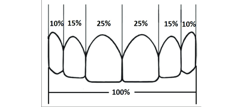 Managing the Midline Diastema Part 2: Challenges Jason Smithson Managing the Midline Diastema Part 2 Figure 4