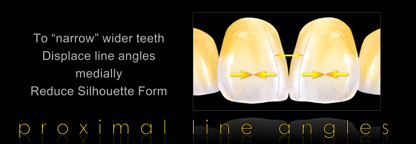 Managing the Midline Diastema Part 2: Challenges Jason Smithson Managing the Midline Diastema Part 2 Figure 6
