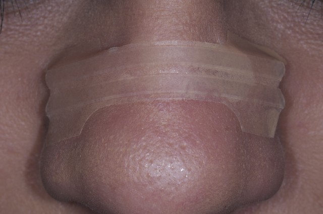 Jeff Rouse Nasal Breathing Keystone to Oral and Systemic Health featured image