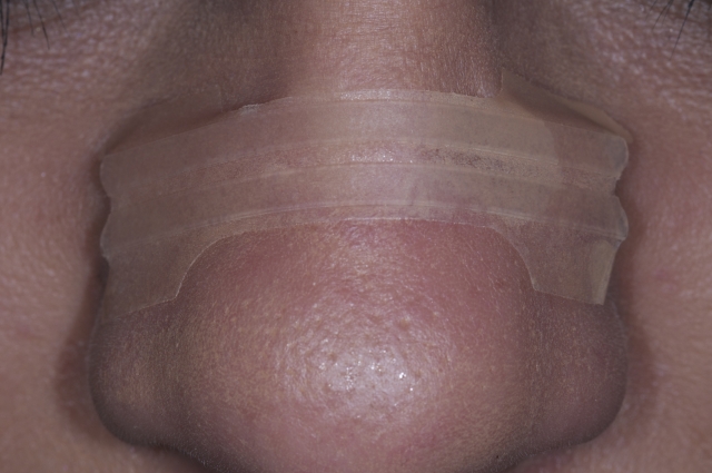 Jeff Rouse Nasal Breathing Keystone to Oral and Systemic Health fig1