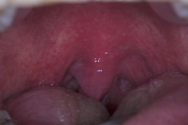 Jeff Rouse Nasal Breathing Keystone to Oral and Systemic Health fig2