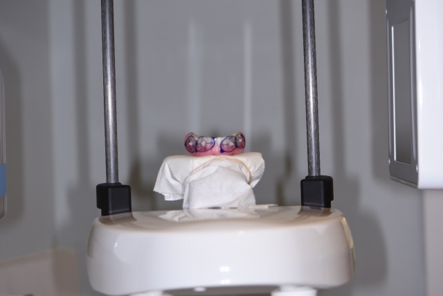 Guided Implant Placement For the Edentulous Arch — Dual Scan Technique JeffLineberry guided implant placement for the edentulous arch dual scan technique Fig.3