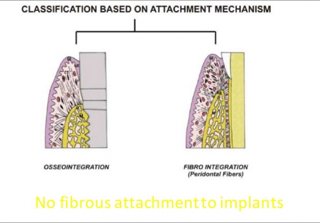 Immediate vs. Delayed Implant Loading JeffreyBonk immediate vs delayed implant loading Fig.9