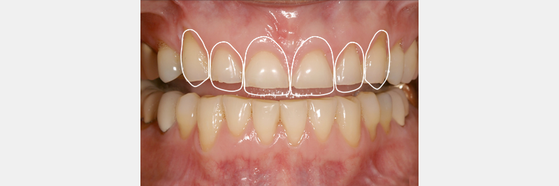 A-EFSB: Airway and 3D Treatment Planning JeffreyRouse airway and 3d treatment planning FIg.2