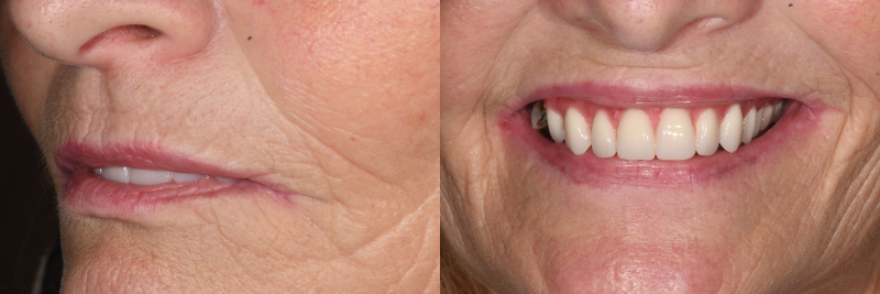 A-EFSB: Airway and 3D Treatment Planning JeffreyRouse airway and 3d treatment planning FIg.3