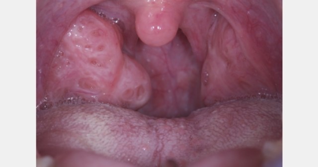 JeffreyRouse dentistry and three common compromised craniofacial anatomy FeaturedImage