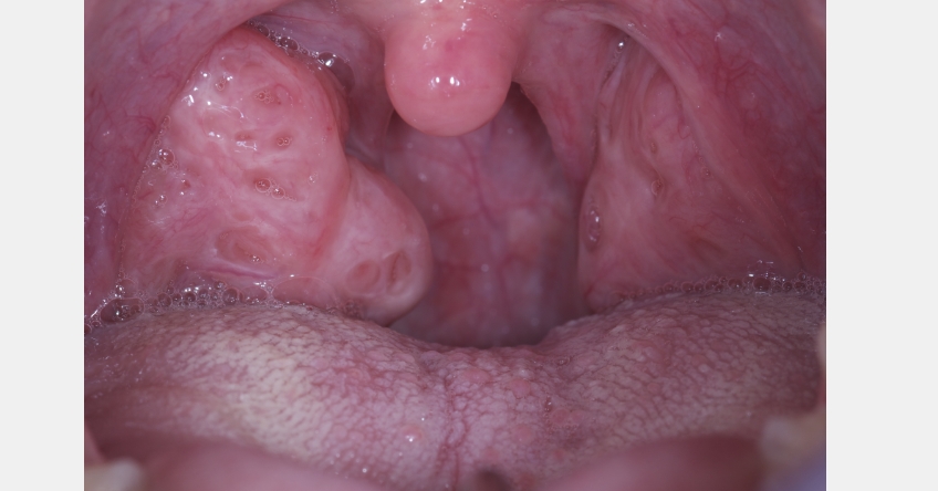 JeffreyRouse dentistry and three common compromised craniofacial anatomy Fig.1