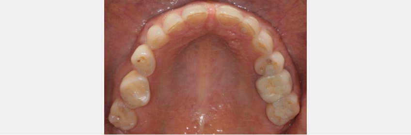 JeffreyRouse maxilla is key comprehensive treatment planning Fig.1