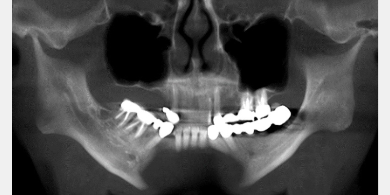 JimMcKee a business model for tmd and airway dentistry Fig.1