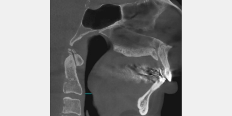 JimMcKee a business model for tmd and airway dentistry Fig.2