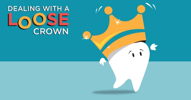 Dealing With a Loose Implant Crown John Carson Dealing With a Loose Implant Crown Featured Image