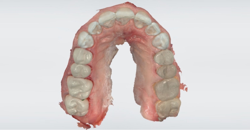 Intraoral Scanning Techniques: Minimizing Errors John Carson Intraoral Scanning Techniques Figure 2