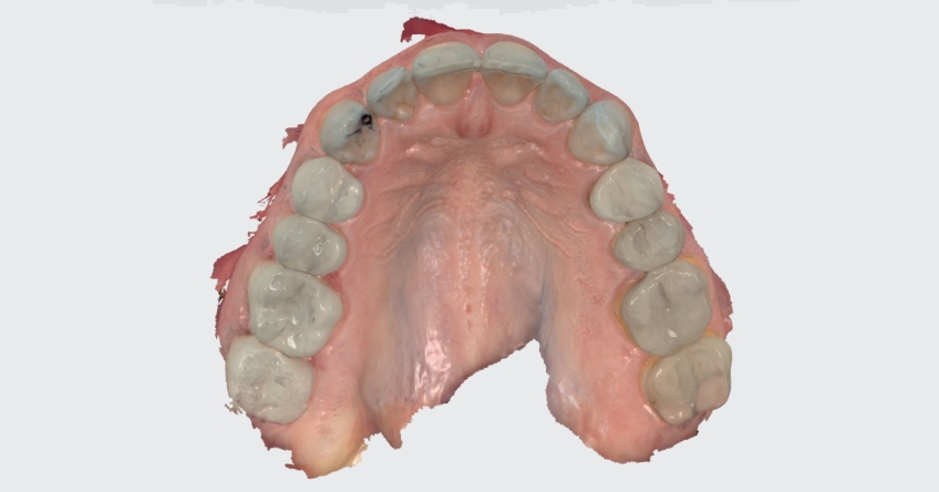 Intraoral Scanning Techniques: Minimizing Errors John Carson Intraoral Scanning Techniques Figure 3