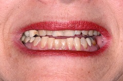 Smile-1 John Carson Managing Patients With Multiple Bites Figure 1