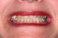 Smile-2 John Carson Managing Patients With Multiple Bites Figure 2