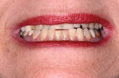 Smile-3 John Carson Managing Patients With Multiple Bites Figure 3