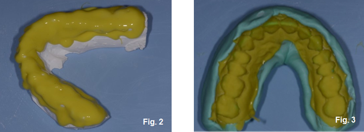 Three Easy Ways to Duplicate Models John Carson Three Easy Ways to Duplicate Models Figure 2 3
