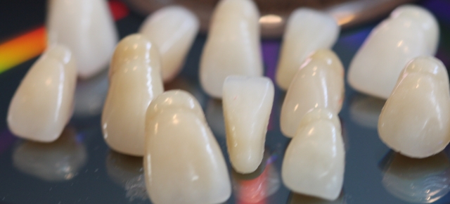 Best Practices for Denture Teeth Selection Kevin Huff Best Practices for Denture Teeth Selection Figure 1