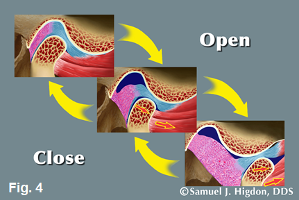 Kevin Kwiecien Using a Leaf Gauge With Intention Figure 4
