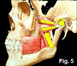Kevin Kwiecien Using a Leaf Gauge With Intention Figure 5
