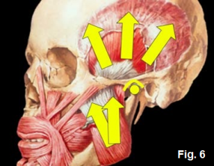 Kevin Kwiecien Using a Leaf Gauge With Intention Figure 6