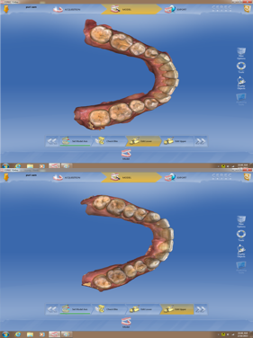 Bite Records For a MAD in the Digital World KevinKwiecien bite records for a mad in the digital world Fig.1