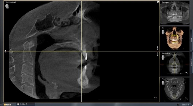 Bite Records For a MAD in the Digital World KevinKwiecien bite records for a mad in the digital world Fig.10