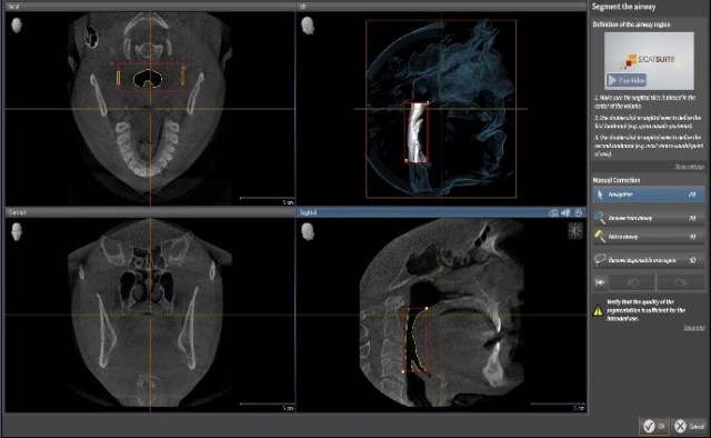 Bite Records For a MAD in the Digital World KevinKwiecien bite records for a mad in the digital world Fig.11