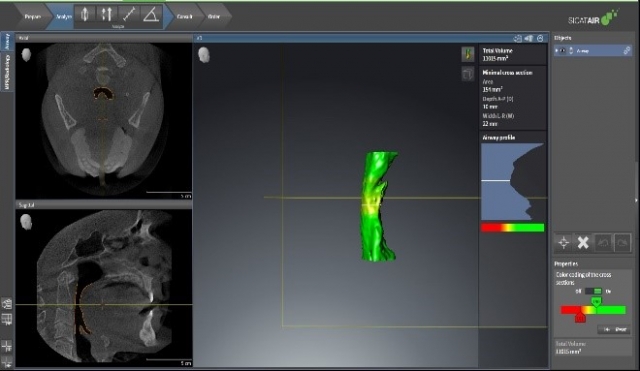 Bite Records For a MAD in the Digital World KevinKwiecien bite records for a mad in the digital world Fig.12