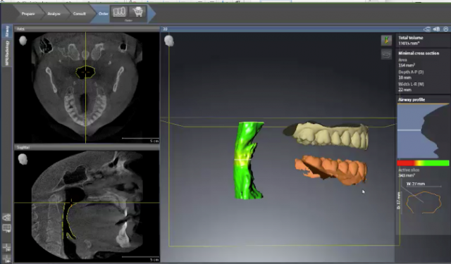 Bite Records For a MAD in the Digital World KevinKwiecien bite records for a mad in the digital world Fig.13
