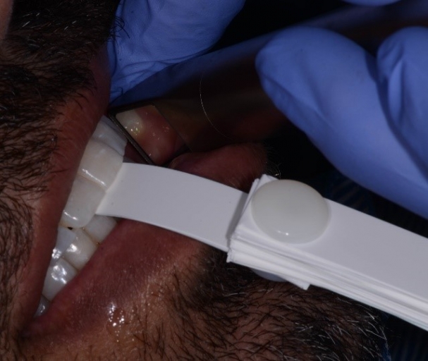 Bite Records For a MAD in the Digital World KevinKwiecien bite records for a mad in the digital world Fig.3