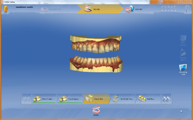 Bite Records For a MAD in the Digital World KevinKwiecien bite records for a mad in the digital world Fig.6