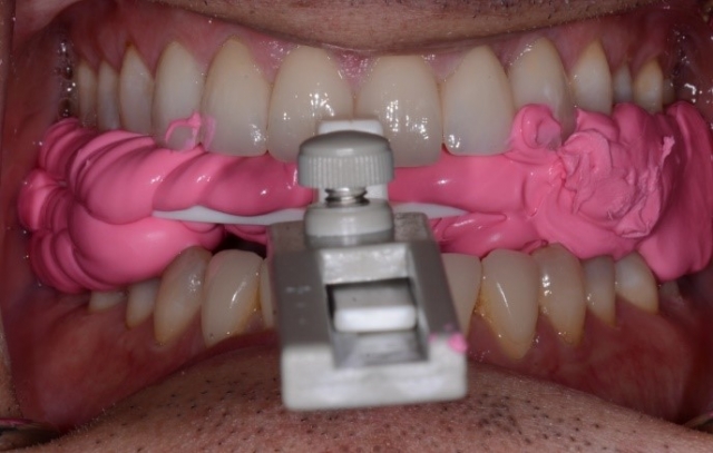 Bite Records For a MAD in the Digital World KevinKwiecien bite records for a mad in the digital world Fig.7