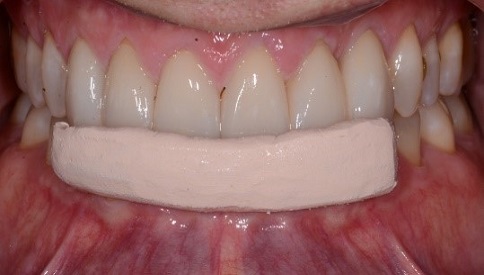 Punishment for ‘Needing’ a MAD: Condemned to Suboptimal Treatment? KevinKwiecien punishment for needing a mad condemned to suboptimal treatment Fig.10