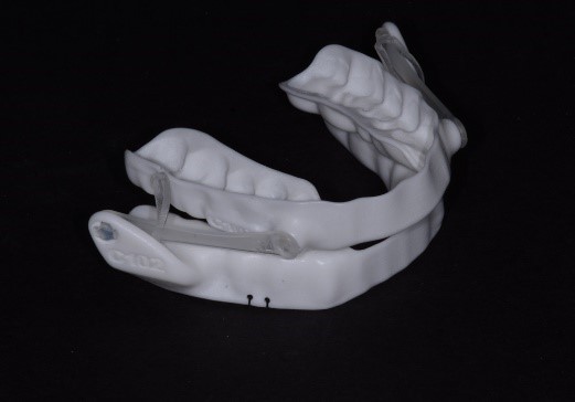 Punishment for ‘Needing’ a MAD: Condemned to Suboptimal Treatment? KevinKwiecien punishment for needing a mad condemned to suboptimal treatment Fig.2