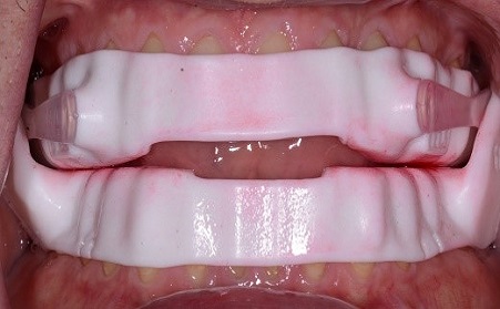 Punishment for ‘Needing’ a MAD: Condemned to Suboptimal Treatment? KevinKwiecien punishment for needing a mad condemned to suboptimal treatment Fig.3