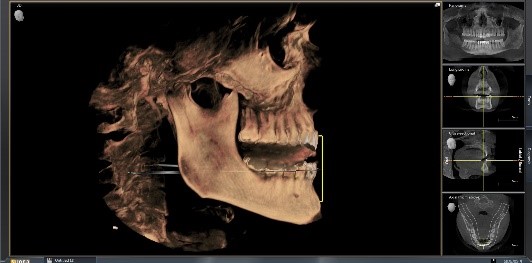 Punishment for ‘Needing’ a MAD: Condemned to Suboptimal Treatment? KevinKwiecien punishment for needing a mad condemned to suboptimal treatment Fig.5