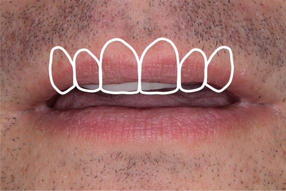 Punishment for ‘Needing’ a MAD: Condemned to Suboptimal Treatment? KevinKwiecien punishment for needing a mad condemned to suboptimal treatment Fig.7