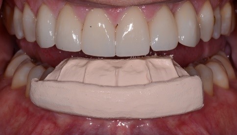 Punishment for ‘Needing’ a MAD: Condemned to Suboptimal Treatment? KevinKwiecien punishment for needing a mad condemned to suboptimal treatment Fig.9