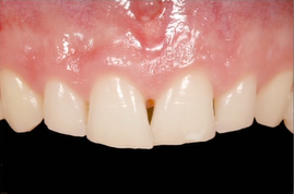 Kinzer Tooth Display Featured Image