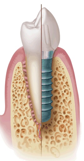 Just the Basics Please, Part II: Restoring the Single Implant Lineberry Just the Basics Pt.2 Featured Image