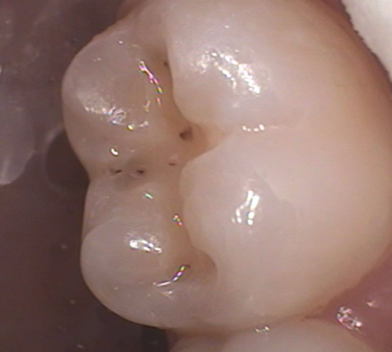 Color Science: Shade Guides and Shade Selection Martin Mendelson Color Science Shade Guides and Shade Selection Figure 1