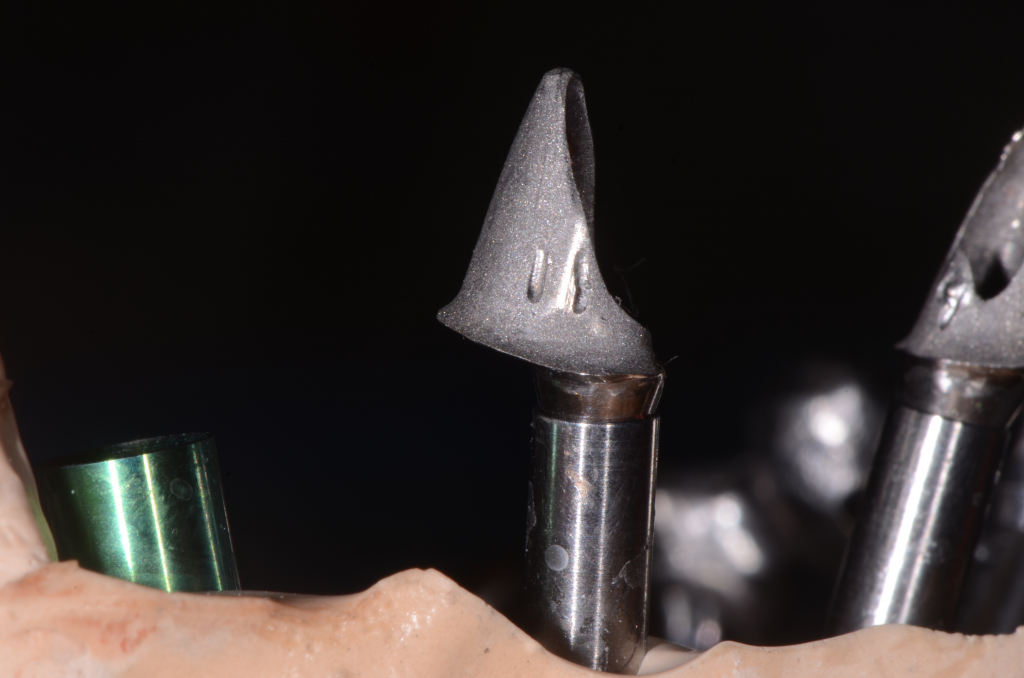 Got Tissue Issues? Mary Anne Salcetti Got Tissue Issues Featured Image