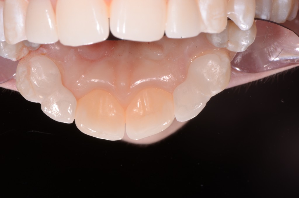 Teachable Moments in Dentistry Mary Anne Salcetti Teachable Moments in Dentistry Featured Image