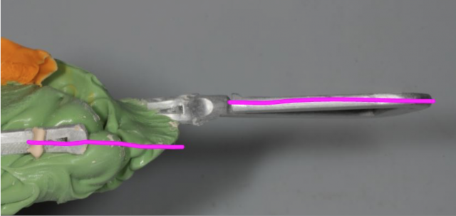 What Is the Best Type of Triple Tray Material? MaryAnneSalcetti what is the best kind of triple tray material Fig.4